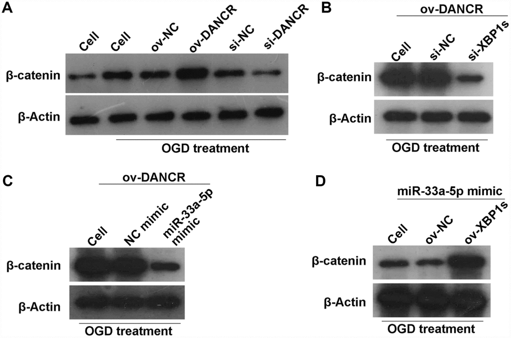 DANCR/miR-33a-5p/XBP1s activates the WNT/β-catenin signaling pathway in OGD-treated BMECs. (A) β-catenin expression was measured by western blotting after transfection of ov-NC, ov-DANCR, si-NC, and si-DANCR in OGD-treated BMECs. (B) β-catenin expression measured by western blotting after transfection of ov-DANCR+si-NC and ov-DANCR+si-XBP1s in the OGD-treated BMECs. (C) β-catenin expression measured by western blotting after transfection of ov-DANCR+NC mimic and ov-DANCR+miR-33a-5p mimic in OGD-treated BMECs. (D) β-catenin expression measured by western blotting after transfection of miR-33a-5p mimic+ov-NC and miR-33a-5p mimic+ov-XBP1s in the OGD-treated BMECs.