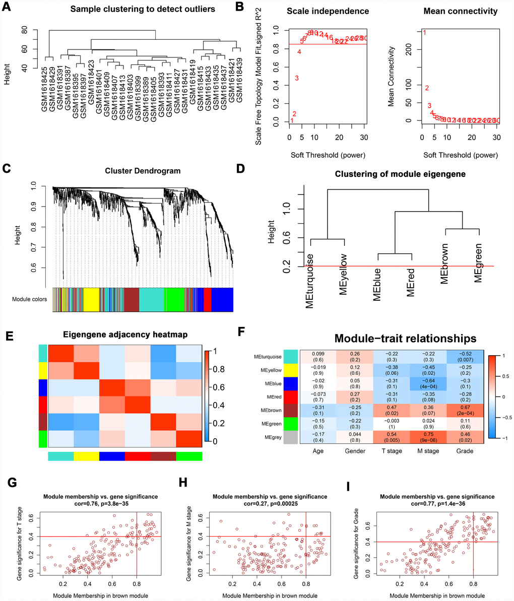 WGCNA of DEGs. (A) Sample clustering of GSE66272 to detect outliers. (B) Analysis of scale-free fit parameter and mean connectivity for various soft-thresholding power. (C) Dendrogram of DEGs clustered based on a dissimilarity measure (1-TOM). The DEGs were divided into seven modules (turquoise, yellow, blue, red, brown, green and grey module). (D, E) Clustering of module eigengene and eigengene adjacency heatmap to calculate the correlation between each module. No modules need to be merged. (F) The brown module was selected as the most important module according to the correlation between MEs and clinical traits. (G–I) Nine genes (TOP2A, NUF2, KIF4A, HJURP, FOXM1, CDCA8, CDCA5, CDC45, and ISG20) were identified as key genes in the brown module due to significantly associated with T stage, M stage, and Grade. WGCNA: weighted gene co-expression network analysis; DEGs: differentially expressed genes; TOM: topological overlap matrix; MEs: module eigengenes; MM: module membership; GS: gene significance.