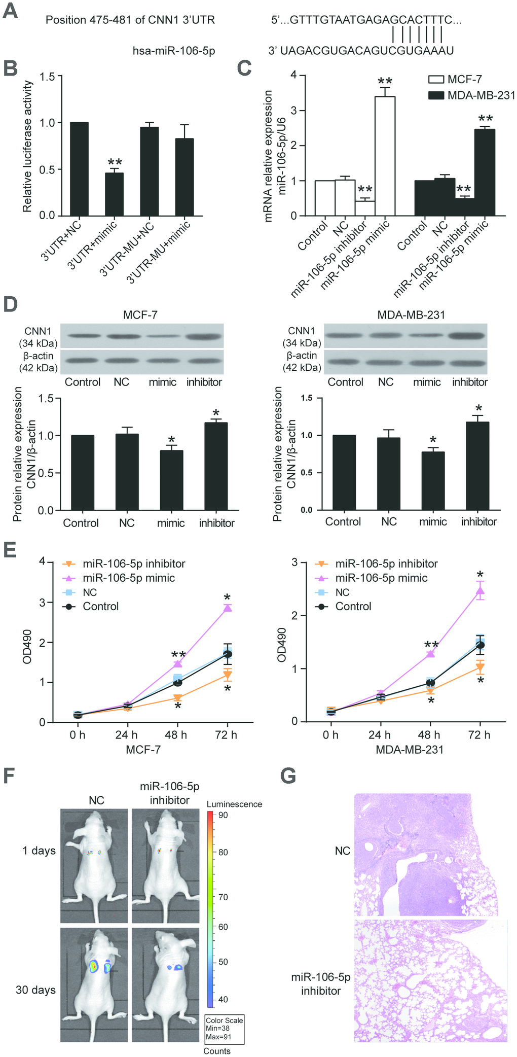CNN1 was the target gene of miR-106b-5p, and the miR-106b-5p promoted cell proliferation. (A) The CNN1 3’UTR contained a binding site of miR-106b-5p by miRDB prediction. (B) The dual-luciferase reporter assay revealed the interaction between CNN1 3’UTR and miR-106b-5p. The HEK293 cells were co-transfected with the miR-106b-5p mimic and CNN1, or miR-106b-5p mimic and mutated CNN1. 3’UTR, wild-type CNN1 containing 3’UTR binding site. mimic, miR-106b-5p mimic. MU, mutated CNN1 without the 3’UTR binding site. NC, negative control. **PC) The qRT-PCR was performed to detect the transfection efficiency of miR-106b-5p mimic and inhibitor in MCF-7 and MDA-MB-231 cells. (D) The miR-106b-5p mimic successfully inhibited CNN1 expression, while the miR-106b-5p inhibitor successfully upregulated CNN1 expression. The CNN1 protein expression was examined by immunoblotting assay after upregulation or downregulation of miR-106b-5p. mimic, the cells were transfected with miR-106b-5p mimic. inhibitor, the cells were transfected with miR-106b-5p inhibitor. (E) The miR-106b-5p mimic enhanced cell proliferation, and the miR-106b-5p inhibitor suppressed cell proliferation. The CCK8 assay was performed to detect the cell proliferation after transfection of miR-106b-5p mimic or inhibitor for 0 h, 24 h, 48 h, and 72 h. *PF) Representative live bioluminescence images from mice treated with MCF-7 cells transfected with negative control or miR-106b-5p inhibitor. (G) Representative hematoxylin and eosin (H&E)-stained lung sections from mice treated with MCF-7 cells transfected with negative control or miR-106b-5p inhibitor.
