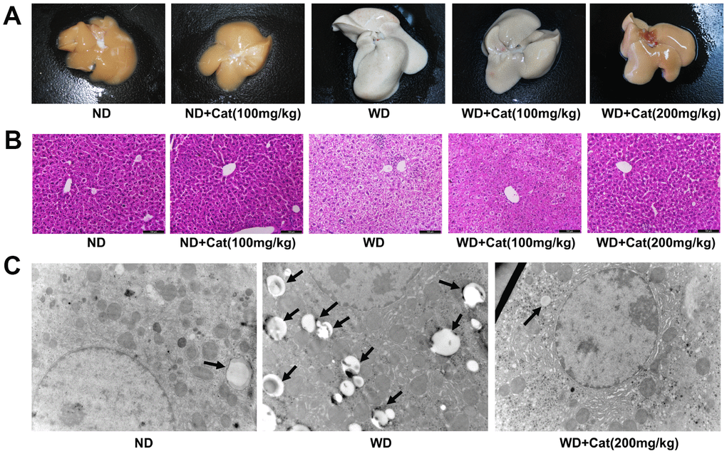 Catalpol ameliorated hepatic steatosis in LDLr-/- mice. The mice were fed with normal or western diet for 16-week, and then sacrificed for morphological and pathological observation. (A) Representative morphological images of liver sections. (B) H&E- stained sections of liver sections. H&E-stained sections were photographed at 200× magnification. (C) Transmission electron microscopy of liver sections. The liver sections were photographed at 10 000× magnification. The lipid droplets were indicated by arrows. ND: normal diet; WD: western diet.