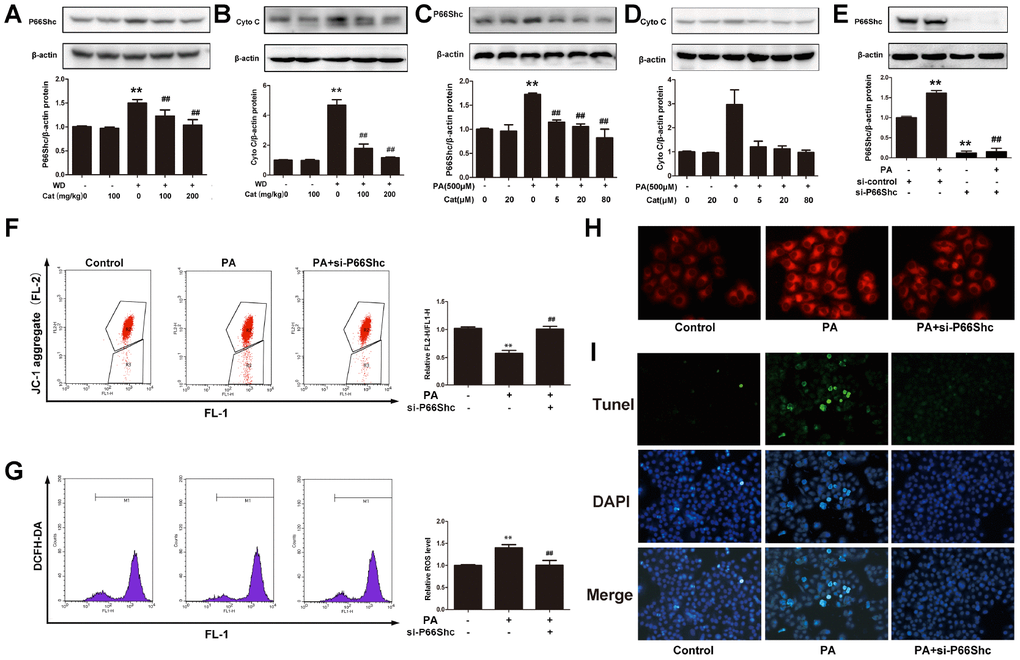 P66shc was involved in catalpol-mediated protective effects. (A) P66shc protein expression in NAFLD mice. (B) Cytochrome C (Cyto C) protein expression in NAFLD mice. (C) P66shc protein expression in PA- treated hepG2 cells. (D) Cyto C protein expression in PA-treated hepG2 cells. (E) P66shc protein expression was down-regulated by its specific siRNA. (F) JC-1 staining. (G) ROS level. (H) Nile red staining. (I) Tunel staining (Tunel positive cells were stained in green; DAPI was stained to show nuclei). The results are the mean± SD (n=10), **P##P 