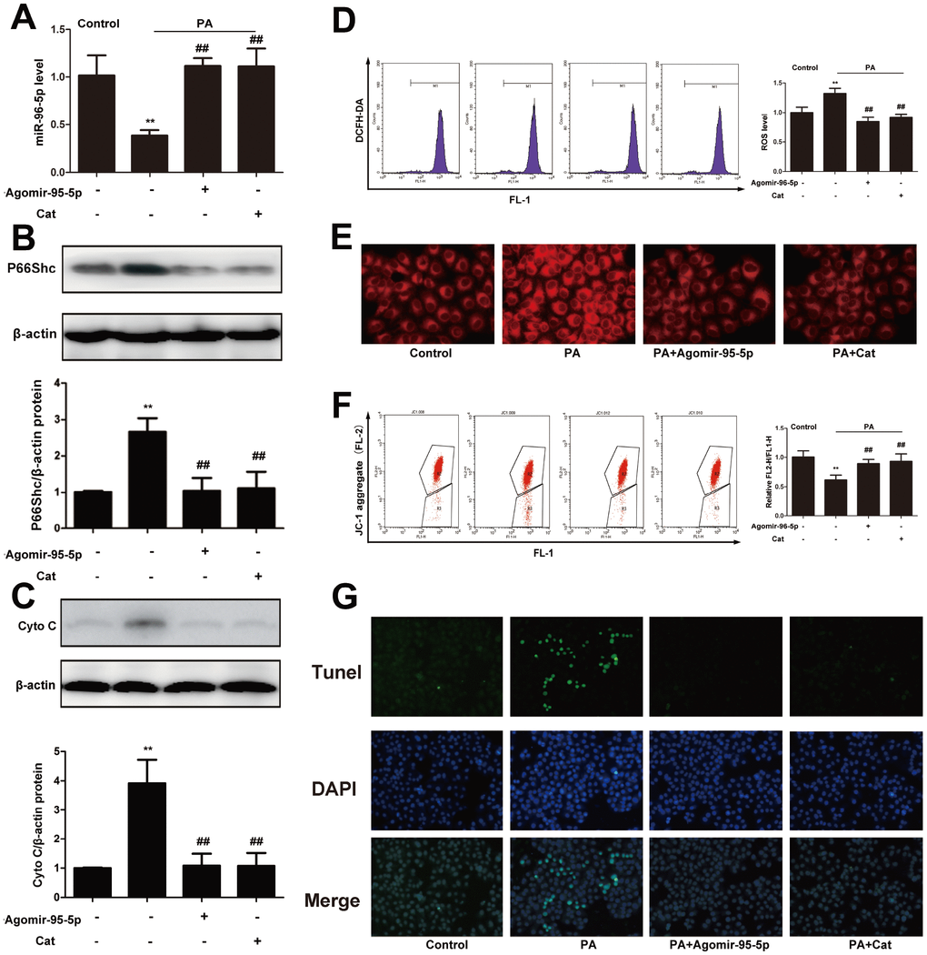 Catalpol ameliorated oxidative stress, hepatic steatosis and apoptosis through upregulating miR-96-5p. (A) miR-96-5p level. (B) P66Shc protein expression. (C) Cyto C protein expression. (D) ROS level. (E) Nile red staining. (F) JC-1 level. (G) Tunel staining. The results are the mean ± SD (n=8), **P##P 