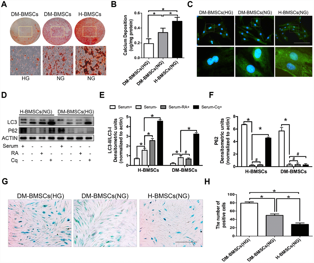 DM-BMSCs show a decreased osteogenic differentiation and autophagy level, and an increased senescent phenotype. DM-BMSCs and H-BMSCS were incubated in the corresponding condition and treated by osteogenic inducement for 14 days and stained with Alizarin Red S (A). Quantitative analysis of the amount of calcium-bound stain was determined by comparison with calcium standards (B). Fluorescence detection of autophagosomes in DM-BMSCs and H-BMSCs transfected with the GFP-LC3 plasmid and cultured in serum deprivation conditions for 6 h (C). The expression of LC3 and P62 were detected by western blot after serum deprivation for 6 h (D). Protein bands were quantified and analyzed by densitometric analysis. Rapamycin (RA) as positive control and chloroquine (Cq) as negative control (E, F). Cell senescence was detected by SA-β-Gal staining after incubation in the corresponding condition (G). The number of positive cells was calculated (H). NG, normoglycemic condition, HG, hyperglycemic condition. Data are presented as the mean ± standard deviation, n=3. *p#p>0.05. Scale bar = 100 μm.