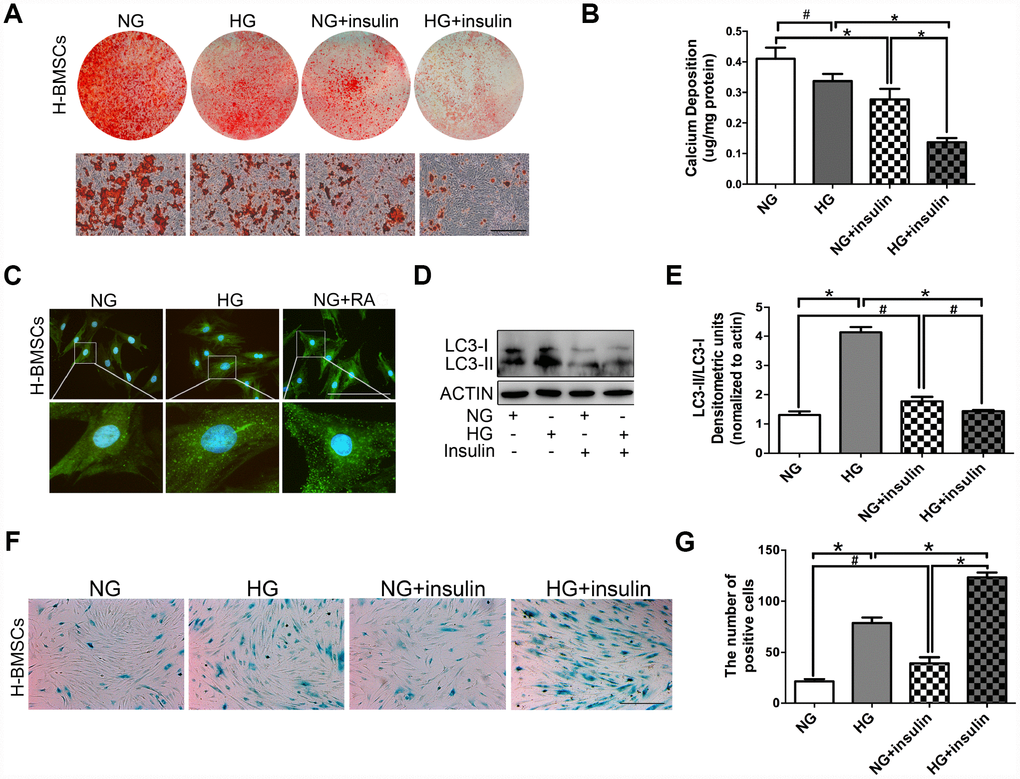 Insulin impedes osteogenic differentiation of H-BMSCs by inhibiting autophagy and inducing senescence. H-BMSCs were incubated under normoglycemic or hyperglycemic conditions with or without of insulin. The amount of calcium accumulation was measured by Alizarin Red S staining after osteogenic inducement for 14 days (A). Quantitative analysis of calcium-bound staining was determined by comparison with calcium standards (B). H-BMSCs were cultured in normal or high-glucose medium. Rapamycin (RA) as positive control. Fluorescence detection of autophagosomes in H-BMSCs were transfected with the GFP-LC3 plasmid and cultured in serum deprivation conditions for 6 h (C). H-BMSCs cultured in normal or high-glucose medium with or without insulin. Western blot analysis showed the conversion of LC3-I into LC3-II after serum deprivation for 6 h (D). Protein bands were quantified and analyzed by densitometric analysis (E). H-BMSCs cultured in normal or high glucose medium with or without insulin for 3 days. H-BMSC senescence was measured by SA-β-Gal staining (F). The number of positive cells was calculated (G). NG, normoglycemic condition, HG, hyperglycemic condition. Data are presented as the mean ± standard deviation, n=3. *p#p>0.05. Scale bar = 100 μm.