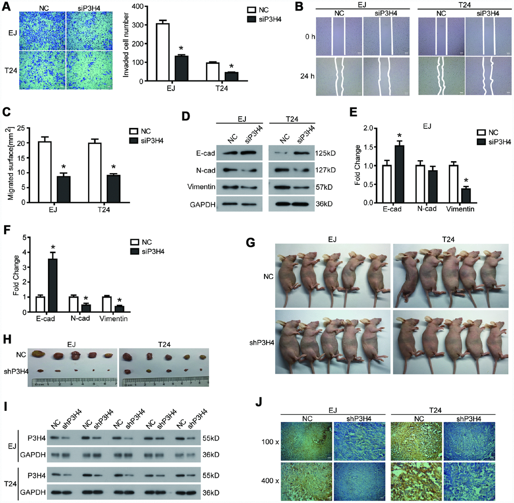 Knockdown of P3H4 inhibits BC cell migration and invasion in vitro and BC growth in vivo. After siP3H4 was transfected into EJ and T24 cells, (A) the invasion ability was determined by Transwell assay, the migration ability was examined (B) and quantified (C) by wound healing assay, (D–F) the expression of EMT-related proteins was detected by western blot. (G) Images of xenograft nude mice after 4 weeks of treatment. (H) Images of subcutaneous tumor. The expression of P3H4 in subcutaneous tumors was examined by western blot (I) and IHC (J). *P 