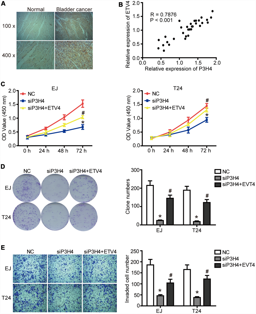 ETV4 is essential for P3H4 to affect BC cell proliferation and motility. (A) ETV4 expression in BC tissues and adjacent normal tissues was examined by IHC. (B) The correlation analysis of P3H4 and ETV4 expression. After siP3H4 and ETV4-overexpression plasmids were co-transfected into EJ and T24 cells, cell proliferation were measured by CCK8 assays (C) and clone formation assay (D), invasion ability was determined by Transwell assay (E). * P