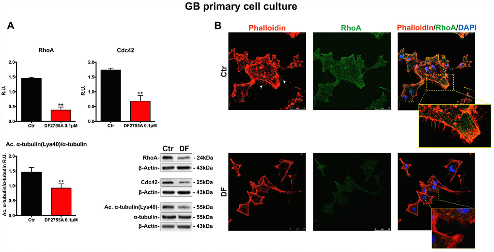 Cytoskeletal and microtubules dynamics are adversely affected by DF2755A in GB primary cell culture. (A) Representative western blotting and relative densitometry analysis for RhoA, Cdc42, Acetylated α-tubulin (Lys40)/α-tubulin. Data are mean ± SEM of three different biological replicates (n=3). Statistical analysis was performed by the unpaired Student's t-test (with Welch’s correction). **, pB) Immunolocalization of RhoA and microfilament decoration by phalloidin-staining in control and DF2755A treated GB primary cell cultures. White arrowheads indicate filopodia, their retraction is clear in magnified images of DF2755A treated cells. Ctr: Control, DF: DF2755A 0.1 μM. Scale bar = 50 μm.