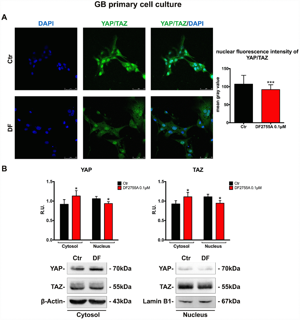 YAP/TAZ nuclear translocation is connected with CXCL8-CXCR1/CXCR2 axis in GB primary cell culture. (A) Immunolocalization of YAP/TAZ in control and treated GB primary cell culture. Ctr: Control, DF: DF2755A 0.1 μM. The nuclear fluorescence intensity quantification (indicated as mean gray value) is also reported (range of cells analysed: 117-142 for GB primary cell culture). Data are mean ±SEM of three different biological replicates (n=3). Statistical analysis was performed by the unpaired Student's t-test (with Welch’s correction). ***, pB) representative western blotting and relative densitometry analysis for cytoplasmic (normalized on β-Actin) and nuclear (normalized on Lamin B1) YAP and TAZ. Data are mean ±SEM of three different biological replicates (n=3). Statistical analysis was performed by the unpaired Student's t-test (with Welch’s correction). *, p
