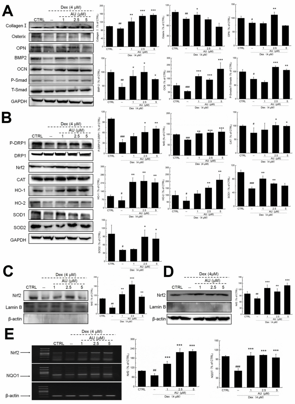 AU protected the Dex-caused MG63 cells apoptosis via regulation the Nrf2/HO-1 signaling. (A) AU up-regulated the expression levels of osteoblast differentiation related proteins including Osterix, OPN, BMP2, OCN and P-Smad in MG63 cells exposed to Dex. (B) AU increased the expression levels of proteins within the Nrf2/HO-1 signaling including P-DPR1, Nrf2, CAT, HO-1, HO-2, SOD-1 and SOD-2 in MG63 cells exposed to Dex. AU enhanced the expression levels of Nrf2 in both (C) nucleus and (D) cytoplasm of MG63 cells exposed to Dex. The quantification data of proteins were normalized by corresponding GAPDH and total proteins, respectively (n=4). (E) AU increased the mRNA levels of Nrf2 and NQO-1 in MG63 cells exposed to Dex. Marker size from top to bottom: 1000 bp, 700 bp, 500 bp, 400 bp, 300 bp, 200 bp and 100 bp. The data on quantified mRNA expression were normalized to the levels of β-actin (n=4). Data are expressed as mean ± S.D. and analyzed using a one-way ANOVA. # PPPvs. control cells, *PPPvs. Dex-exposed cells.