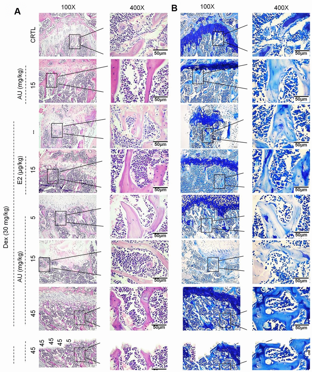 The effects of AU on the femoral histological changes of osteoporotic mice were detected by (A) H&E staining and (B) Giemsa staining (n=6).
