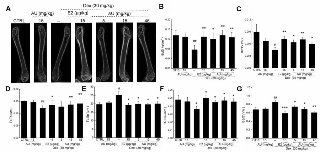 The effects of AU on the femoral bone morphological changes and the levels of osteoporotic indexes of osteoporotic mice. (A) The photographs of femur in osteoporotic mice detecting via micro-CT. The levels of (B) BMD, (C) BV/TV, (D) Tb.Th, (F) Tb.N and (G) BS/BV among all groups were analyzed. Data are expressed as mean ± S.D. (n=6) and analyzed using a one-way ANOVA. # PPvs. CTRL mice, *PP