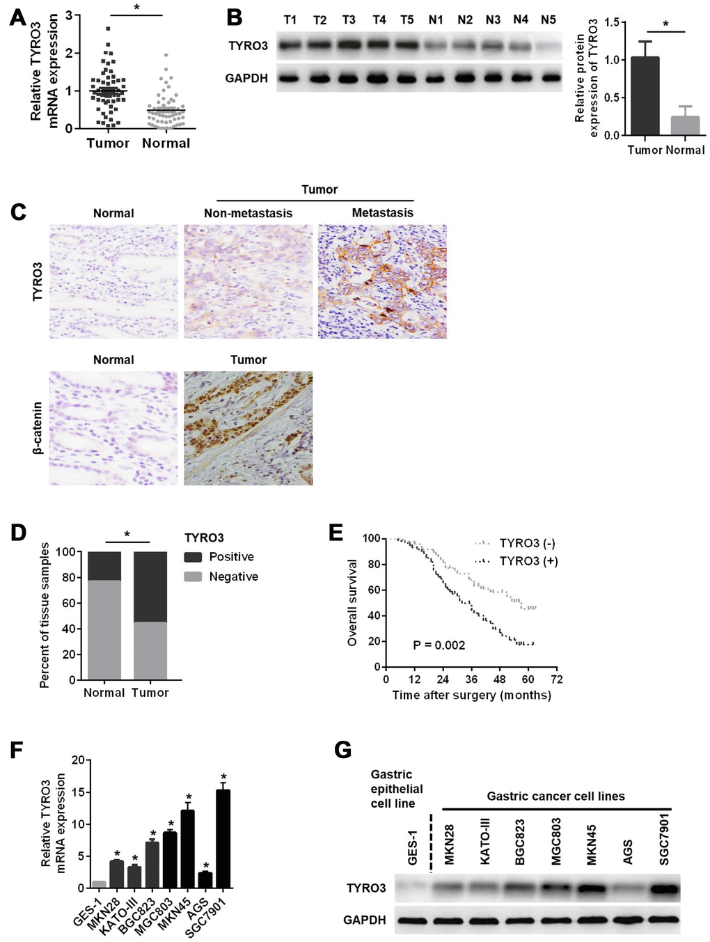 Relative TYRO3 expression in gastric cancer (GC) tissues and cell lines. (A) The qRT-PCR analysis of TYRO3 mRNA expression in 55 paired specimens of GC tumor tissues versus corresponding normal tissues. (B) Western blot analyses of TYRO3 protein expressions in 55 paired specimens of GC tissues versus matched normal tissues. (C) Representative images of TYRO3 and β-catenin staining in surgical specimens from 110 paired of GC tissues with or without metastasis and adjacent normal tissues. (D) Quantitative evaluation of TYRO3 expression in tumor tissues and matched normal tissues according to staining scores. (E) Kaplan-Meier analysis of overall survival in patients with variable expression of TYRO3. (F) The qRT-PCR analysis of TYRO3 mRNA expression in GC cell lines and normal gastric epithelial GES-1 cells. (G) Western blot analyses of TYRO3 protein expressions in GC cell lines and normal gastric epithelial GES-1 cells. Glyceraldehyde 3-phosphate dehydrogenase was used as a loading control. *P 