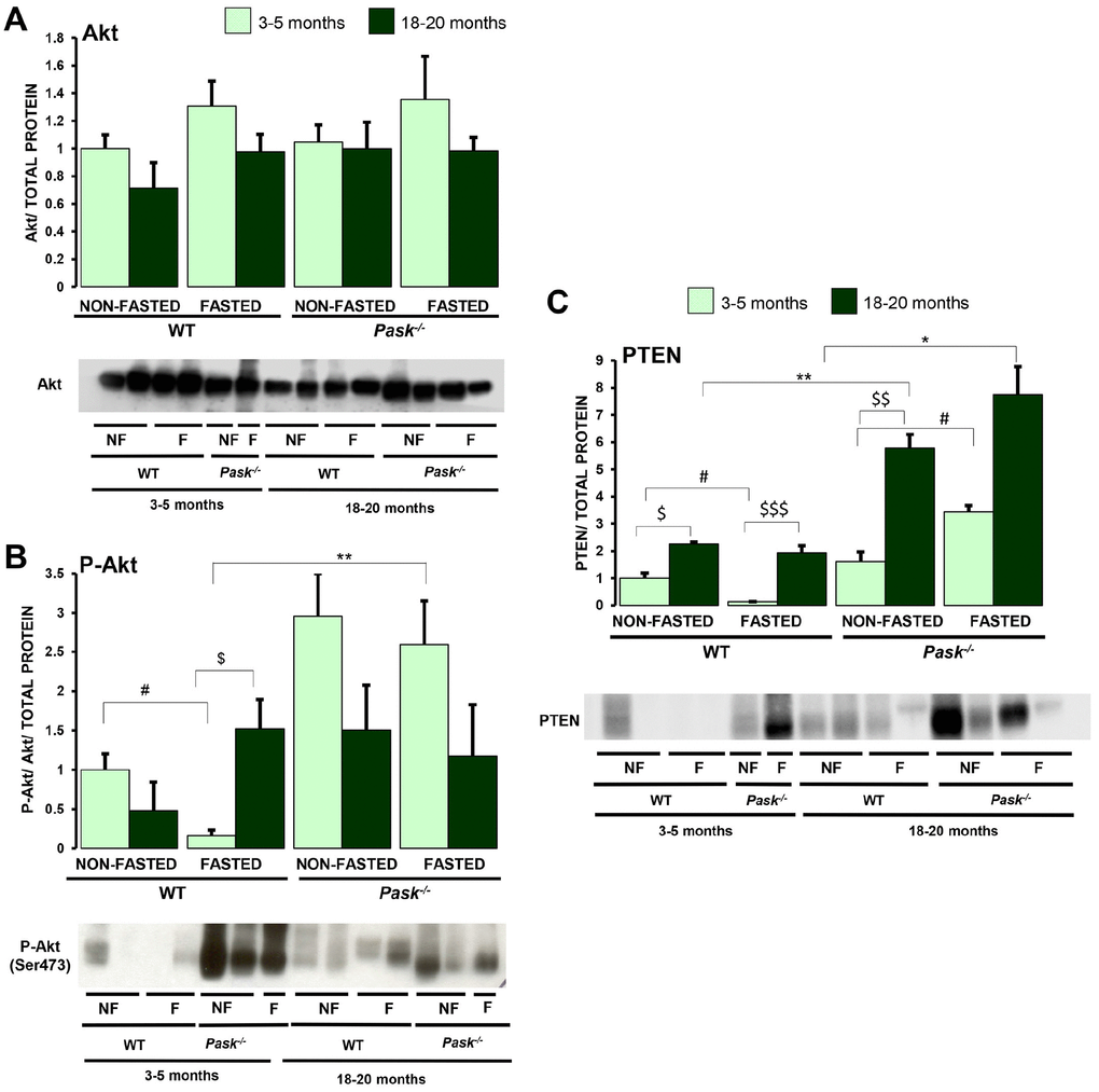 Effects of aging and PASK deficiency on Akt and PTEN protein levels. Immunoblot analysis of total Akt (Akt) (A), phospho-Akt (Ser473) (P-Akt) (B) and PTEN (PTEN) (C) in livers from young (3-5 months) and aged (18-20 months) wild-type (WT) and PASK-deficient (Pask-/-) mice. Liver lysates from non-fasted (NF) and 24-h fasted (F) mice were processed for western blot analysis. The value obtained for non-fasted 3-5-month-old WT mice was taken as 1. Bar graphs represent the means ± SEM of the densitometric values normalized by total protein detected by Stain-Free (TOTAL PROTEIN) (Supplementary Figure 1); n = 4-5 animals per condition. $P $$P $$$P vs. 18-20 months; * P P vs. Pask-/-; #P vs. fasted.