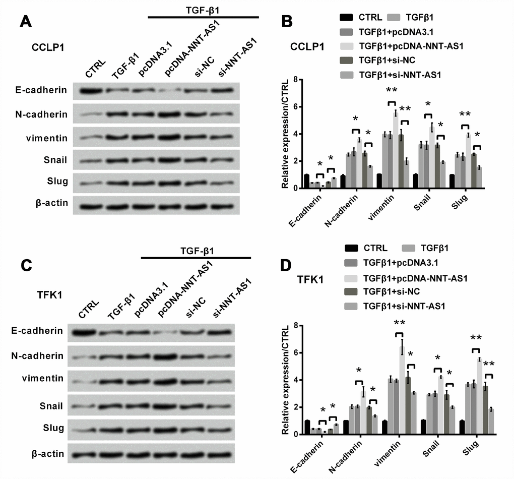 Effect of NNT-AS1 on EMT in CCLP1 and TFK1 cells, which were transfected with pcDNA-NNT-AS1 and si-NNT-AS1. Expression of EMT relative factors was examined via western blot (A, C) and analyzed quantitatively (B, D) in CCLP1 and TFK1 cells. * P P 