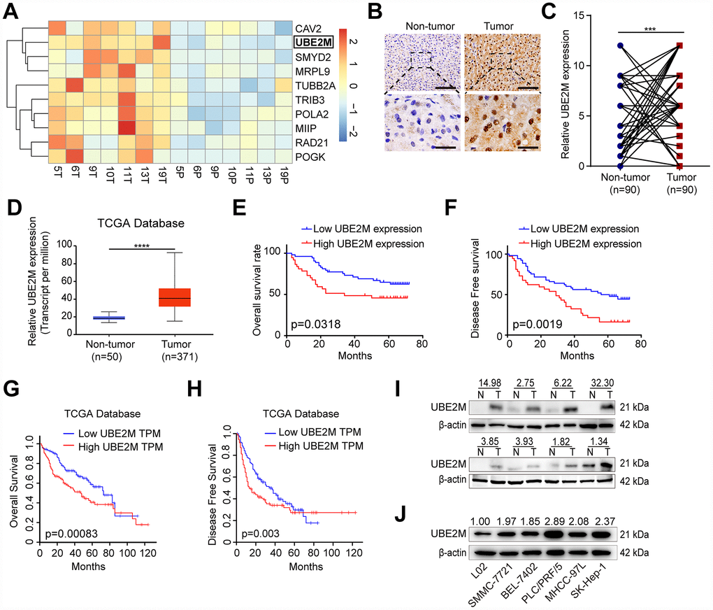 Overexpressed UBE2M in HCC tissues and cell lines. (A) Heatmap showing differential expression of genes in 7 paired HCC tissues using a mRNA microarray. (B) Representative images showing UBE2M expression in HCC and paired non-tumor tissues (Scale bar, 400 μm in the upper panel, and 100 μm in the lower panel). (C) UBE2M expression in HCC and paired non-tumor tissues using a pair-wise comparison analysis (***P D) UBE2M expression in 371 HCC and 50 non-tumor tissues obtained from The Cancer Genome Atlas (TCGA) database (****P t-test). Adapted from UALCAN: http://ualcan.path.uab.edu/index.html. (E) A Kaplan-Meier plot showing the overall survival rate of HCC patients with low- and high-UBE2M expression in our HCC cohort (P = 0.0318, log-rank test). (F) A Kaplan-Meier plot showing the disease-free survival of HCC patients with low- and high-UBE2M expression in our HCC cohort (P = 0.0019, log-rank test). (G) A Kaplan-Meier plot showing the overall survival rate of HCC patients with low- and high-UBE2M expression in TCGA database (P = 0.00083, log-rank test; TPM, transcript per million). Adapted from GEPIA: http://gepia.cancer-pku.cn/index.html. (H) A Kaplan-Meier plot showing the disease-free survival of HCC patients with low- and high-UBE2M expression in TCGA database (P = 0.003, log-rank test). Adapted from GEPIA: http://gepia.cancer-pku.cn/index.html. (I) UBE2M protein expression in 8 pairs of HCC tissues by Western blotting (N, non-tumor; T, tumor). (J) UBE2M protein expression in five HCC cell lines and normal hepatocytes L02 by Western blotting.