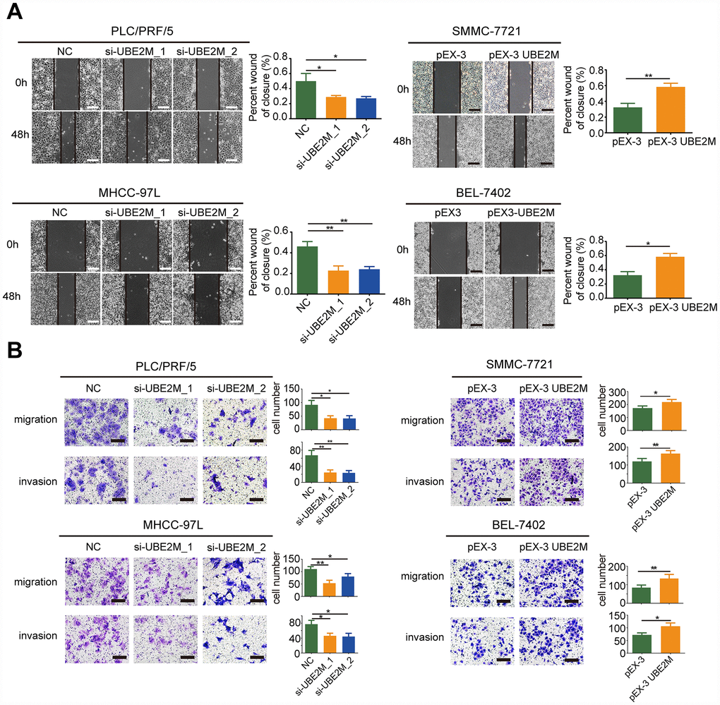 UBE2M mediates cell migration and invasion in vitro. (A) UBE2M knockdown remarkably suppressed cell migration in PLC/PRF/5 and MHCC-97L cells, while UBE2M overexpression significantly increased cell migration in SMMC-7721 and BEL-7402 cells, as demonstrated by wound-healing assay (scale bar, 50 μm). (B) Knockdown of UBE2M remarkably suppressed cell migration in PLC/PRF/5 and MHCC-97L cells, while overexpression of UBE2M significantly increased cell migration in SMMC-7721 and BEL-7402 cells, as determined by Transwell migration. Moreover, knockdown of UBE2M significantly reduced invasion capacity, while overexpression of UBE2M promoted invasion capacity, as revealed by Matrigel invasion assay (scale bar, 200 μm). Data was presented as mean ± SD (n = 3), *P P P t-test).