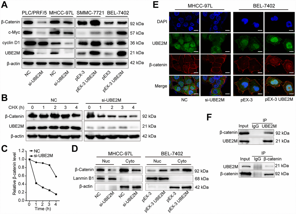 UBE2M regulates the expression of cyclin D1 through stabilizing β-catenin. (A) The protein expression level of β-catenin, cyclin D1, and c-Myc in UBE2M-silencing PLC/PRF/5 and MHCC-97L cells, as well as in UBE2M-overexpressing SMMC-7721 and BEL-7402 cells by Western blotting. (B) MHCC-97L cells transfected with NC siRNA and si-UBE2M for 48h, prior to addition of CHX (100 μg/mL). Cell lysates were prepared at the indicated times (0, 1, 2, 3, and 4 h) following addition of CHX, and analyzed by Western blotting. (C) Quantification of β-catenin protein levels in MHCC-97L cells at the indicated times as described in (B). (D) Nuclear and cytoplasmic fractions of MHCC-97L and BEL-7402 cells were isolated, and β-catenin expression was determined in the nuclear and cytoplasmic protein by Western blotting. (E) Nuclear and cytoplasmic expressions of UBE2M and β-catenin were analyzed by immunofluorescence staining in the MHCC-97L and BEL-7402 cells (Scale bar, 15 μm). (F) The physical interaction between UBE2M and β-catenin was examined by a co-IP assay in MHCC-97L cells. IgG was used as a negative control.