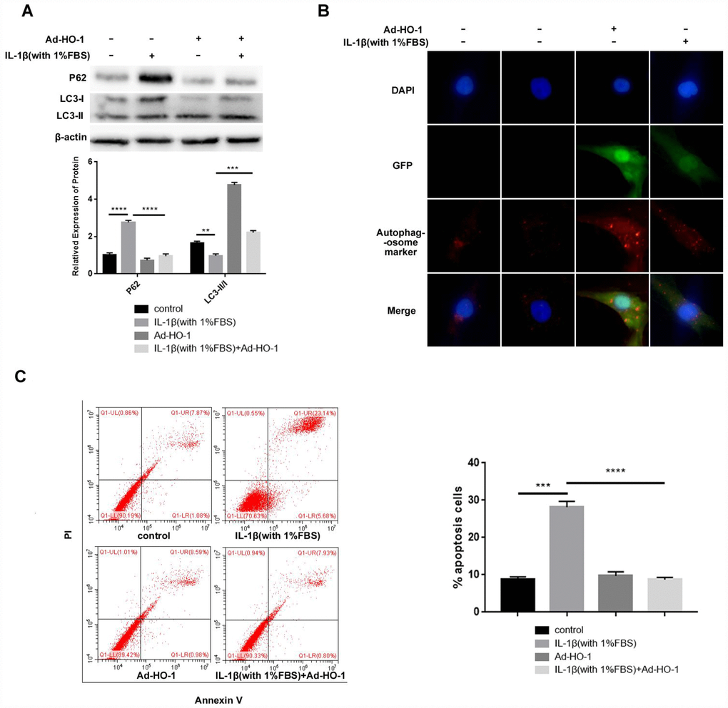 HO-1 overexpression suppresses apoptosis induced by IL-1β in the human NPCs. (A) Western blot shows the expressions of P62 and LC3-II/I protein levels in NPCs, which were transfected with Ad-HO-1 for 48 h and then stimulated with IL-1β (10ng/mL) plus 1% FBS for 24 h. Note: The data represents mean ± SD of three experiments; ****pB) Immunofluorescence assay shows formation of autophagosomes in HO-1 overexpressing NPCs stimulated with IL-1β (10ng/mL) plus 1% FBS for 24 h. (C) Flow cytometry shows percentage apoptosis of HO-1 overexpressing NPCs after treatment with IL-1β (10ng/mL) plus 1% FBS for 24 h. Note: The data represents mean ± SD of three experiments; ****p