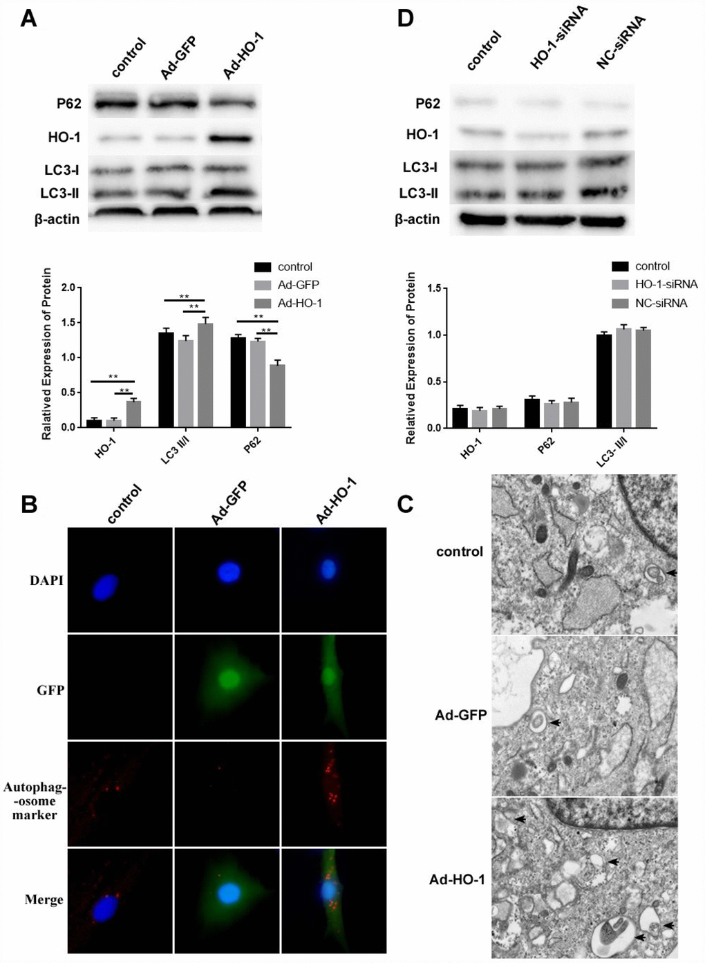 HO-1 overexpression induces autophagy in human NPCs. (A) Western bolt shows HO-1, P62 and LC3-II/I protein levels in control and HO-1 overexpressing NPCs. HO-1 overexpressing NPCs were generated by transfecting Ad-HO-1 for 48 h. Note: The data represent mean ± SD of three experiments; **pB) Immunofluorescence assay results show autophagosome formation based on staining of the control and HO-1 overexpressing NPCs with antibodies against the autophagosome marker protein SQSTM1/P62. (C) Transmission electron micrographs show characteristic double-membrane autophagosome formation (black arrows) in control and HO-1 overexpressing NPCs. (D) Western bolt shows HO-1, P62 and LC3-II/I protein levels in control and HO-1 siRNA transfected NPCs. As shown, there is no significant difference in the levels of these proteins in all experimental groups. Note: The data represent mean ± SD of three experiments.