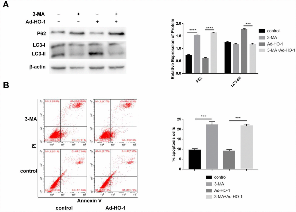 Autophagy inhibition by 3-MA enhances apoptosis in HO-1 overexpressing NPCs. (A) Western blot shows P62 and LC3-II/I protein levels in HO-1 overexpressing NPCs treated with or without 10 mM 3-MA. Briefly, NPCs were transfected with Ad-HO-1 for 48 h and then treated with 10 mM 3-MA to inhibit autophagy for 24 h. (B) Flow cytometry shows apoptotic rate of cells when HO-1 overexpressing NPCs were treated with or without 10 mM 3-MA. Note: All the experiments were repeated at least three times independently; ****P