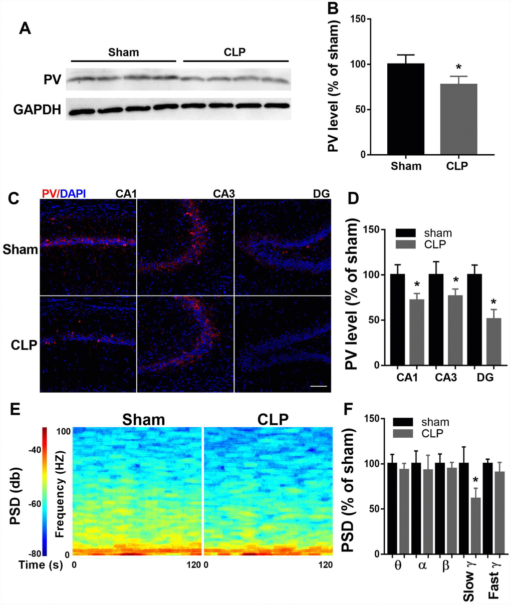 Altered hippocampal PV expression and LFP after CLP. (A–B) PV expression decreased significantly at 14 days after CLP compared with sham group (n = 4). (C–D) Decreased PV expression was observed in all subregions of the hippocampus 14 days after CLP (n = 4). (E–F) Slow γ oscillation band was significantly decreased in CLP group when compared with sham group, but there was no difference in θ, α, β, or fast γ band power between these two groups (n = 3). Data are shown as mean ± SD, *P 