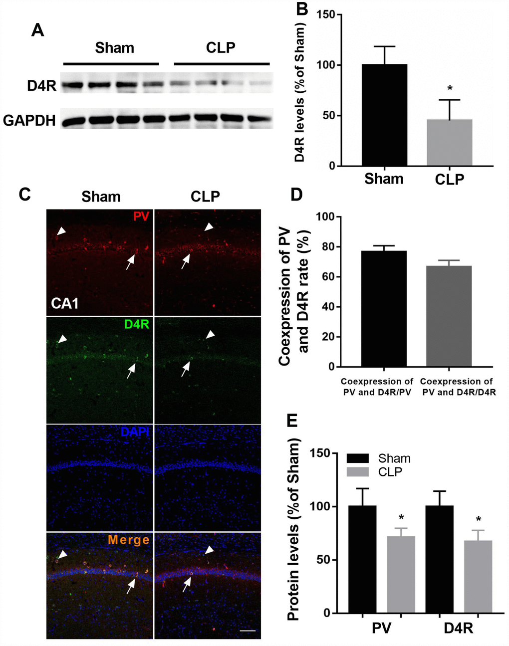 D4 receptor colocalizes in cells positive for PV and was decreased after CLP. (A–B) D4 receptor was significantly decreased after CLP. (C–D) Most PV interneurons co-express D4 receptor and a large proportion of D4 receptor-expressing neurons in the hippocampus co-express PV. Arrow: coexpress D4 receptor and PV; Arrowhead: express D4 receptor without parvalbumin. (C and E) Decreased PV and D4 expressions were observed after CLP when compared with sham + NS group. *P 