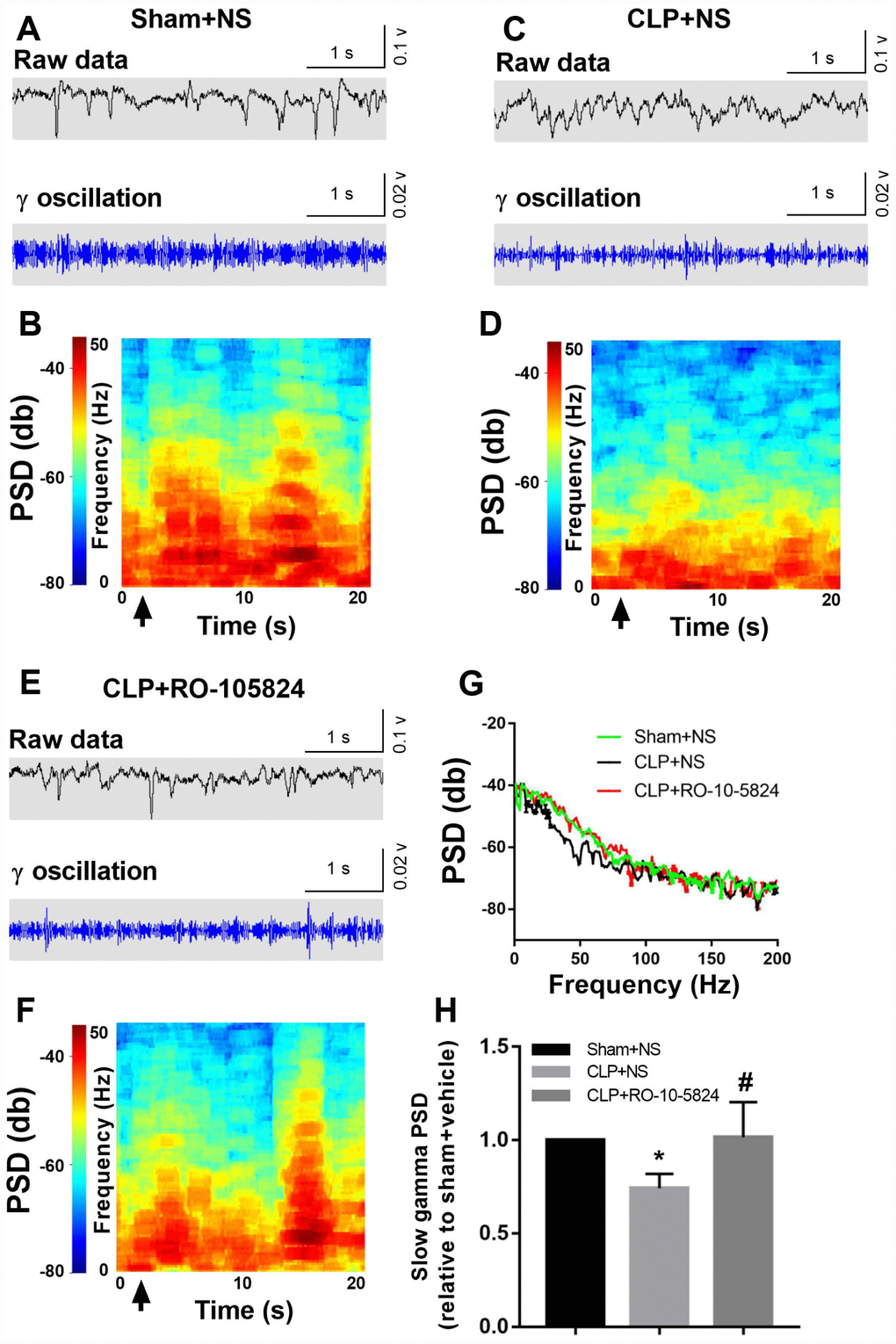 RO-10-5824 treatment reversed CLP-induced decreased slow γ band power. (A–F) Example recordings and example power spectra of γ oscillations in the hippocampal area CA1 of sham, CLP + NS, and CLP + RO-10-5824 groups. (G–H) Summary of LFP power. The slow γ band power was significantly higher in CLP + RO-10-5824 group when compared with CLP + NS group. Data are shown as mean ± SD (n = 5), *P #P 