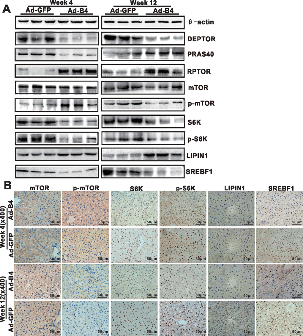BMP4 down-regulates the mTORC1 signaling pathway in mouse liver. The liver samples prepared in Figure 3 were used for the following assays. (A) Total cell lysate was prepared from the retrieved liver samples and subjected to Western blotting analysis of the expression of the members of mTORC1 signaling pathway. (B) The retrieved liver samples were paraffin-embedded, sectioned and subjected to IHC staining to detect the expression of the members of mTORC1 signaling pathway and lipid metabolism. Each assay condition was done in triplicate, and representative images are shown.