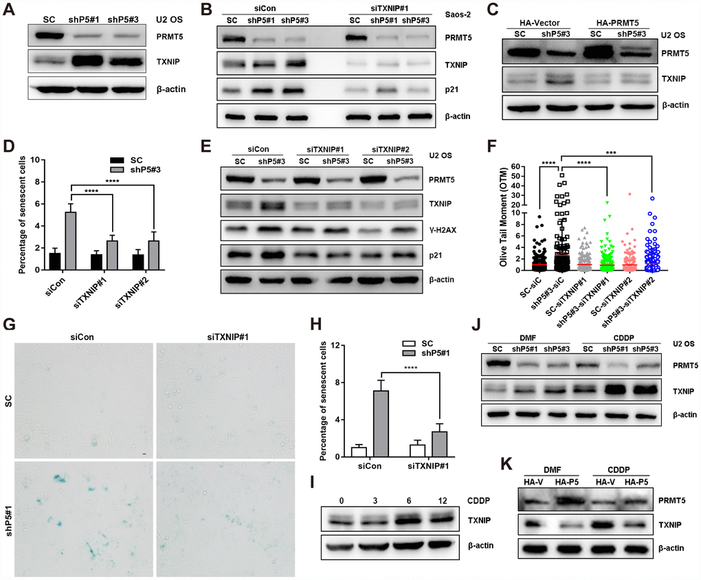 TXNIP is essential for the induction of cellular senescence by PRMT5 depletion. (A) The protein expression of TXNIP was determined by WB with or without PRMT5 knockdown in U2 OS cells. (B) siRNA targeting TXNIP was transfected into SC, shP5#1 or shP5#3 Saos-2 cells, and the expressions of PRMT5, TXNIP, and p21 were measured by WB; β-actin was used as the internal control. (C) Plasmids encoding HA-PRMT5 were transfected into SC or shP5#3 U2 OS cells, and the expression of PRMT5 and TXNIP was determined by WB. (D) Two independent siRNAs targeting TXNIP (siTXNIP#1 and siTXNIP#2) were transfected into SC or shP5#3 U2 OS cells for 3 days, the percentage of senescent cells was quantified. ****, pE) siRNAs targeting TXNIP were transfected into SC, shP5#1 or shP5#3 U2 OS cells, and the expressions of PRMT5, TXNIP, γ-H2A.X, and p21 were measured by WB; β-actin was used as the internal control. (F) DSBs were quantified by Open Comet software. ***, ppG, H) siRNA targeting TXNIP was transfected into SC and shP5#1 U2 OS cells, and cellular senescence was visualized using a SA-β-gal staining kit. Scale bar = 10 μm. the percentage of senescent cells was quantified. ****, pI) U2 OS cells were treated with CDDP for different durations, the expression of TXNIP was measured by WB. (J) 10 μM CDDP was added to SC, shP5#1, and shP5#3 cells for 12 h, the expressions of PRMT5 and TXNIP were determined by WB. (K) U2 OS cells were transfected with plasmids encoding HA-PRMT5, followed by treated with CDDP for 12 h, the expressions of PRMT5 and TXNIP were determined by WB.