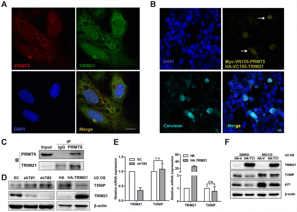 TRIM21 interacts with PRMT5 in U2 OS cells. (A) Colocalization of TRIM21 and PRMT5 was observed in U2 OS cells using antibodies against TRIM21 (green) and PRMT5 (red). Scale bar = 20 μm. (B) DAPI was used to indicate nuclei. Myc-VN155-PRMT5 and HA-VC155-TRIM21, along with HA-cerulean, were cotransfected into U2 OS cells for 48 h, and the reconstituted Venus fluorophore (yellow, arrows) was visualized via confocal microscopy. Scale bar = 20 μm. (C) The endogenous interaction between TRIM21 and PRMT5 was validated using a co-IP assay. (D, E) shRNAs targeting TRIM21 (shT#1 and shT#2) or plasmid encoding HA-TRIM21 were applied to knock down or overexpress TRIM21, and the protein and mRNA levels of TRIM21 and TXNIP were then determined by WB or quantitative real-time PCR, respectively. (F) Dox-inducible TRIM21-expressing cells was treated with MG132 (10 μM) for 12h, the protein expression of TRIM21, TXNIP, and p21 was then determined by WB.