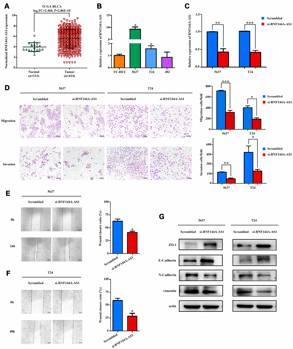 RNF144A-AS1 enhances the invasion and migration of bladder cancer cells in vitro. (A) The expression of RNF144A-AS1 in samples from TCGA-BLCA Project. (B) Quantitative real-time PCR analysis of RNF144A-AS1 expression in 5637, T24, J82 and SV-HUC cells. (C) Quantitative real-time PCR analysis of RNF144A-AS1 expression in RNF144A-AS1-silenced cells and scrambled-siRNA-treated cells. (D) The migration and invasion abilities of 5637 and T24 cells were assessed with Transwell assays after the knockdown of RNF144A-AS1. (Left panel) Representative images of migration (upper) and invasion (lower) assays. (Right panel) The number of cells that migrated or invaded are shown in the histogram. The effects of knocking down RNF144A-AS1 on the migration of 5637 (E) and T24 cells (F) were assessed with wound-healing assays. Representative images (left panel) and histogram (right panel). (G) The protein levels of E-cadherin, ZO-1, N-cadherin and Vimentin were detected by Western blotting in the RNF144A-AS1-knockdown group. Data are represented as the mean ± standard deviation of triplicate determinations from three independent experiments. Statistical significance was assessed with an unpaired Student’s t test (two-tailed test). *PPP