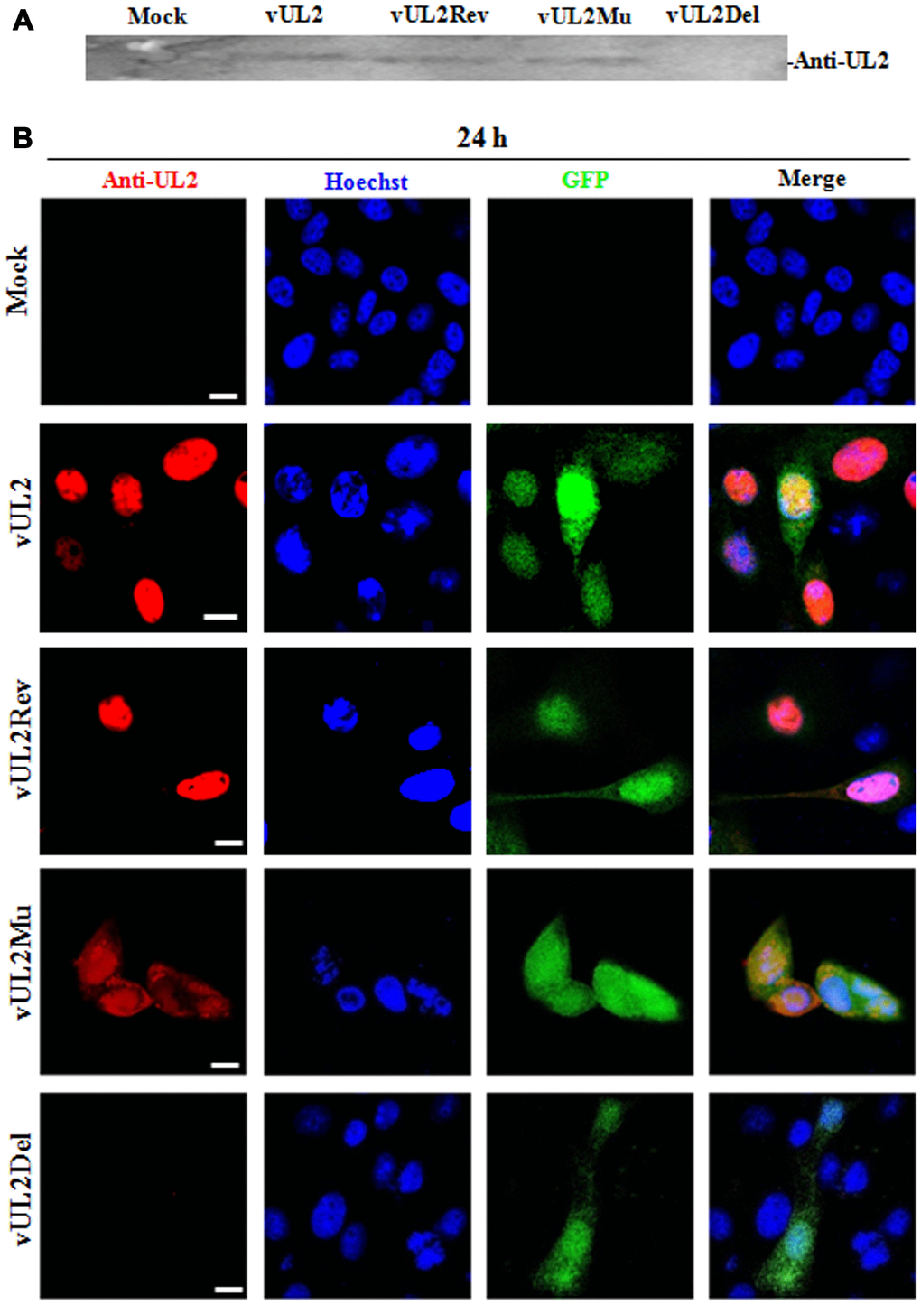 Protein expression and subcellular localization of UL2 in different recombinant viruses-infected cells. (A) Monolayer HEK293T cells were infected with different reconstitute virus vUL2, vUL2Del, vUL2Mu or vUL2Rev at an MOI of 1 for 24 h, and cells were harvested when CPE reached 90-95%. Cell lysates were then subjected to WB analysis using the prepared anti-UL2 pAb and AP-conjugated goat anti-rat IgG. (B) Vero cells infected with different reconstitute virus vUL2, vUL2Del, vUL2Mu or vUL2Rev at an MOI of 1 for 24 h, then cells were subjected to IFA using anti-UL2 pAb and Dylight 649 conjugated goat anti-rat IgG, to show the subcellular localization of UL2. Cells were finally counterstained with Hoechst to visualize the nuclei. GFP was also captured to show the cells were successfully infected by HSV-1. All scale bars indicate 10 μm.