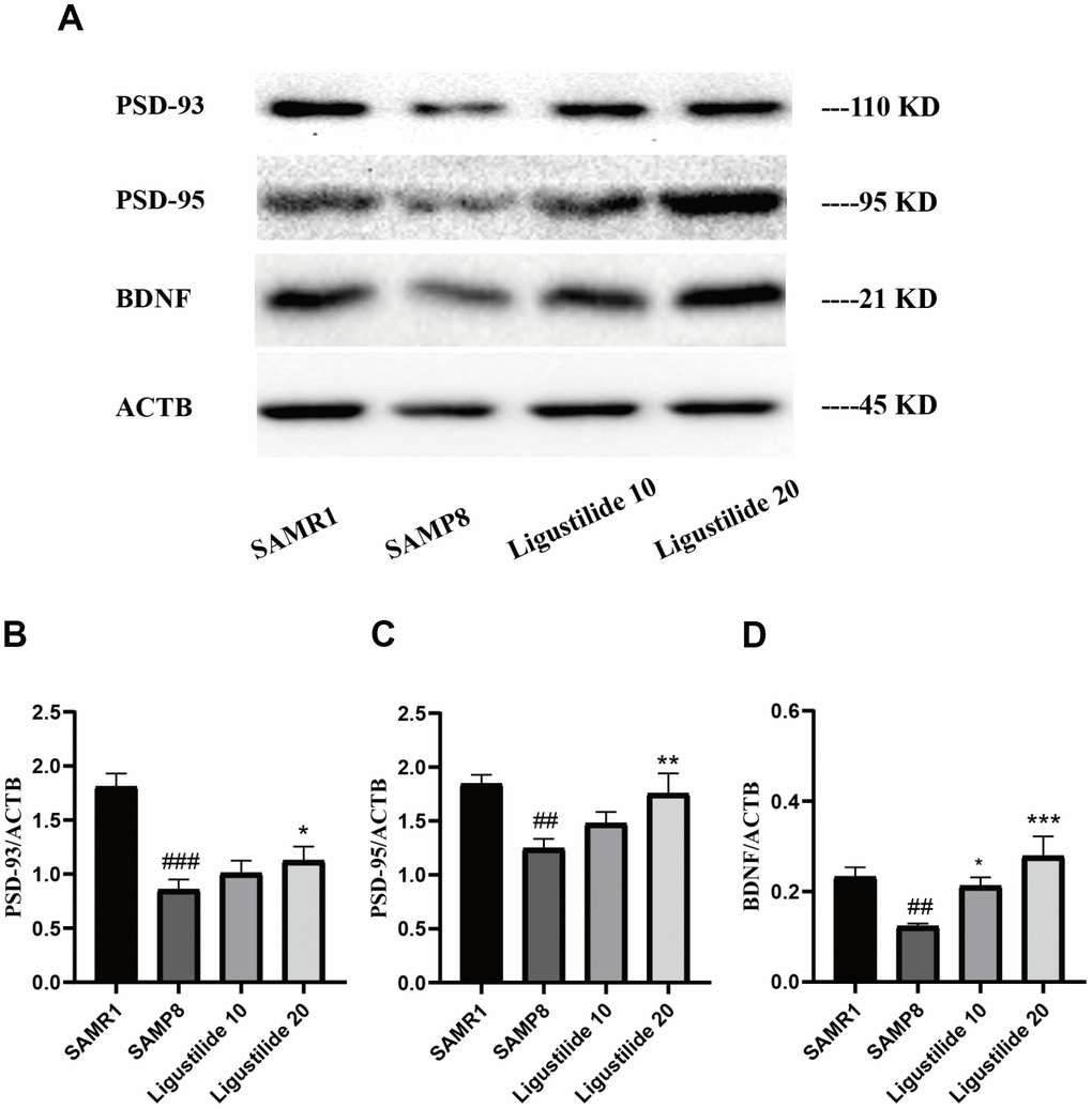 Ligustilide ameliorates neurodegeneration in SAMP8 mice. (A) Western blot analysis of (B) postsynapticdensity 93 (PSD93), (C) postsynapticdensity 95 (PSD95) and (D) BDNF. Ligustilide 10 (10 mg/kg/d); Ligustilide 20 (20 mg/kg/d). Data represent mean ± SD (n = 20 per group). #p p p p p p 