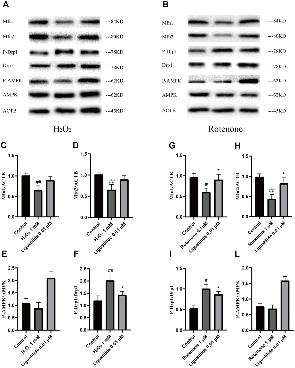 Ligustilide attenuates H2O2-induced and Rotenone-induced mitochondrial impairment in HT22 cells. (A, B) Western blotting was used to detect mitochondrial morphology-related proteins (C, G) Mfn1. (D, H) Mfn2. (E, L) P-Drp1. (F, I) P-AMPK.. Ligustilide 10 (10 mg/kg/d); Ligustilide 20 (20 mg/kg/d). Data represent mean ± SD (n = 20 per group). #p p p p p p 