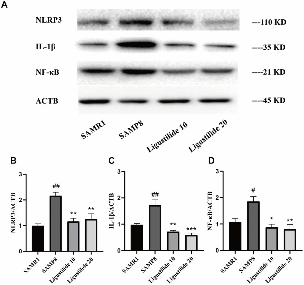 Ligustilide reduces neuroinflammation levels. (A) The levels of (B) NLRP3, (C) IL-1β and (D) NF-κB were detected in the hippocampus. Ligustilide 10 (10 mg/kg/d); Ligustilide 20 (20 mg/kg/d). Data represent mean ± SD (n = 20 per group). #p p p p p p 