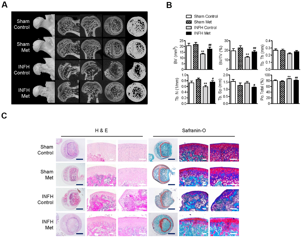 Protective effect of metformin in the INFH rat model. (A) Representative images of μCT in sham-operated rats with saline injection (Sham Control), sham-operated rats with metformin injection (Sham Met), INFH-operated rats with saline injection (INFH Control), and INFH-operated rats with metformin injection (INFH Met). Images are arranged in order of 3D μCT reconstructions of femoral head area and the coronal, sagittal, and middle areas of femoral heads. (B) Morphometric indices in femoral heads of the four groups. Values are presented as the mean ± STD (n = 5). **p C) Representative images of H & E and Safranin-O staining in the four groups. Black bars = 500 μm, white bars = 50 μm. Abbreviations: BV, bone volume; Tb. N, trabecular number; Tb.Sp, trabecular separation; Tb.Th, trabecular thickness; TV, tissue volume; Po, porosity.