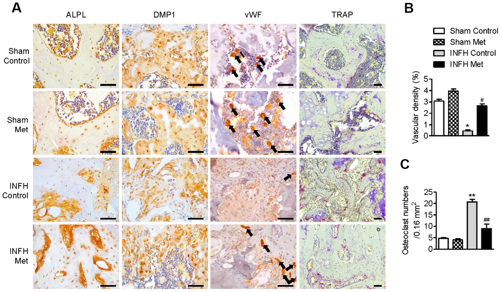 Working mechanism of metformin in the INFH rat model. (A) Immunohistochemical staining of ALPL, DMP1, vWF, and TRAP in the femoral head epiphysis. Black arrows indicate positive expression of vWF, a marker of endothelial cells of blood vessels. (B) Percentage of vascular density in the four groups. Vascular density (%) was calculated as vascular area stained by antibody for vWF-related antigen/total area of each image. Values are presented as the mean ± STD. (n = 4). *p C) Number of TRAP-positive cells per unit area. Values are presented as the mean ± STD (n = 4). **p 