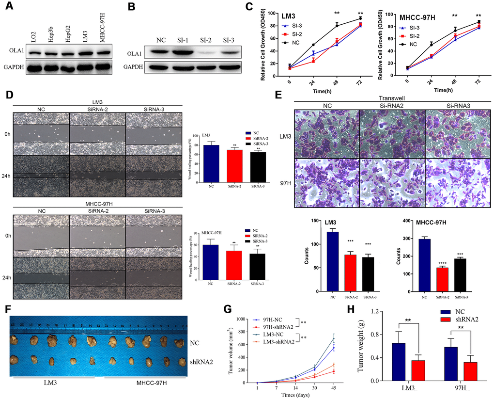Inhibition of OLA1 represses the proliferation, migration, invasion and tumorigenicity of HCC cells. (A and B) OLA1 was highly expressed in LM3 and MHCC-97H cells and inhibited by transfection with OLA1-siRNA. (C) OLA1 silencing repressed the proliferation of HCC cells. (D) OLA1 downregulation inhibited cell migration after transfection. (E) The transwell Matrigel penetration assay showed that OLA1 promoted the invasion of HCC cells. (F–H) OLA1 silencing significantly reduced tumor growth and tumor weight in xenografts carrying HCC cells. (I) Ki-67 was significantly downregulated in OLA1-knockout tumors, as shown by IHC. All *p