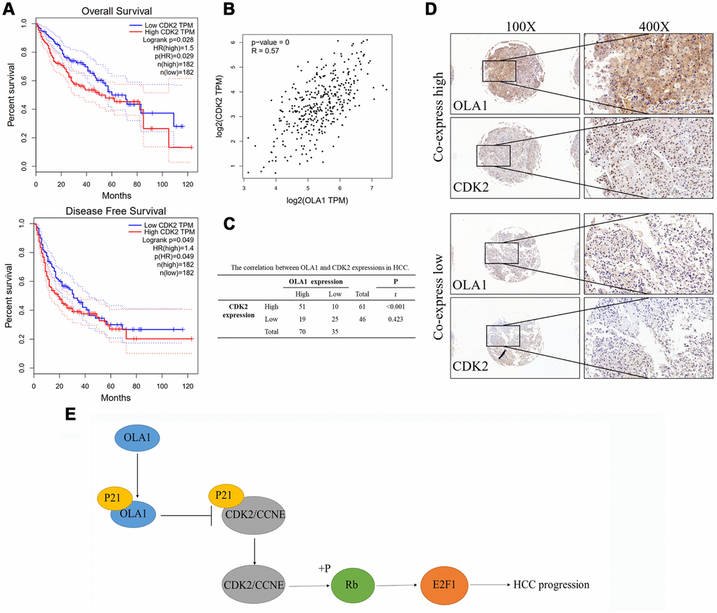 OLA1 correlates with CDK2 in HCC. (A) High expression of CDK2 was associated with poor survival outcomes of HCC. (B) CDK2 expression level is highly relevant to OLA1 expression. (C) Our HCC clinical samples also demonstrated a high correlation of OLA1 and CDK2. (D) Representative images of OLA1 and CDK2 co-expression staining in HCC specimens. (E) Schematic of the above-mentioned findings. OLA1 influences cell cycle, apoptosis and progression in LM3 and MHCC-97H cells by the interaction with P21 and upregulation of CDK2.