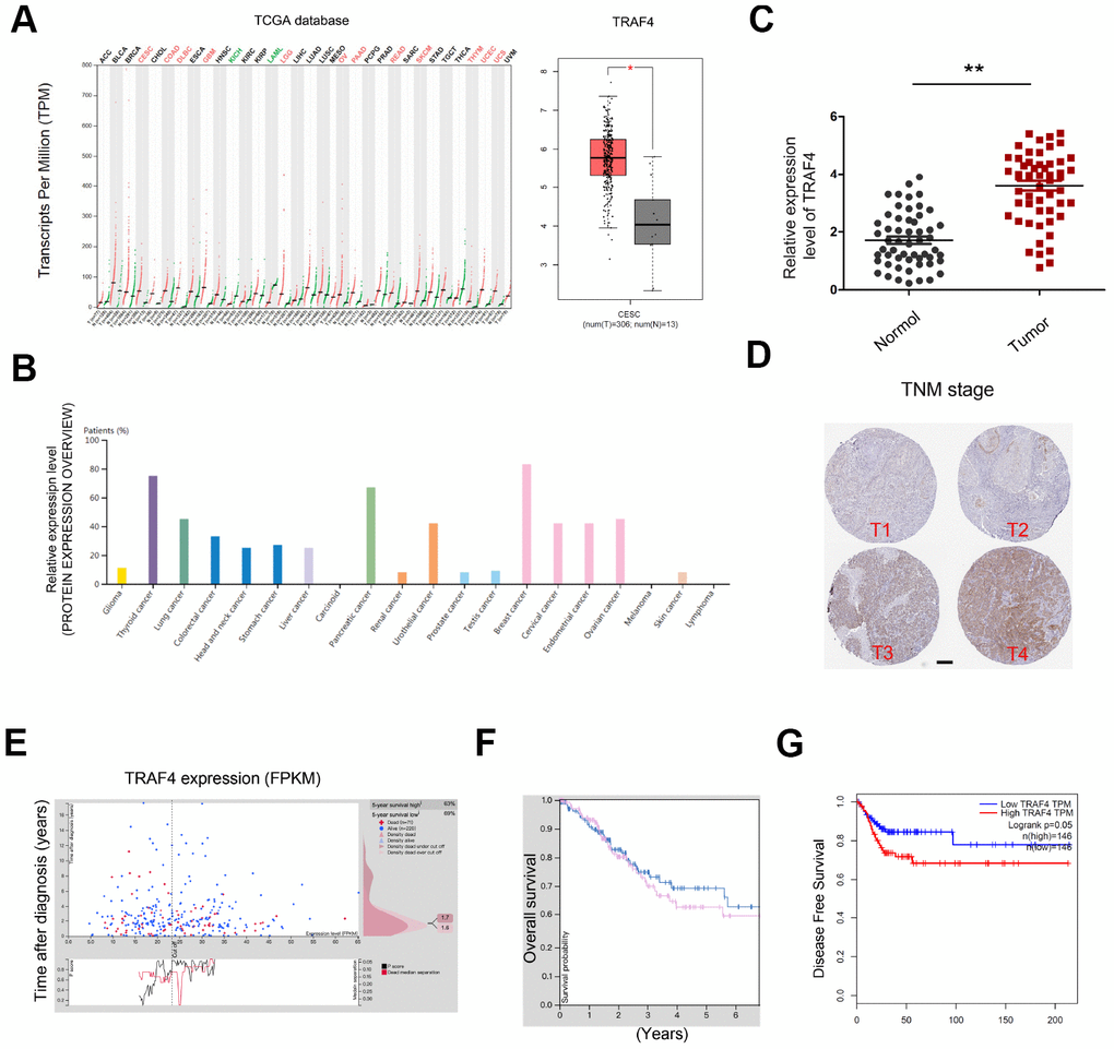 TRAF4 expression in CC. (A, B) TRAF4 expression in the TCGA database. (C) TRAF4 expression was upregulated in CC tissues. (D) High TRAF4 expression was associated with advanced TNM stage. (E–G) High TRAF4 expression was associated with poor overall survival and disease-free survival in CC patients. *P