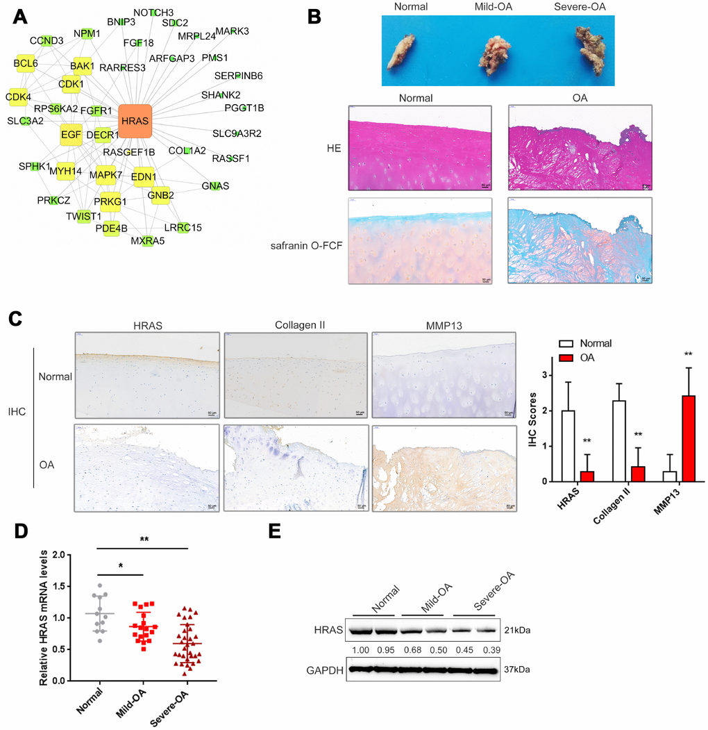 Screening and validation of HRAS expression in tissue samples. (A) The protein-protein interactions of the differentially expressed genes (both up and down regulated) were retrieved from the String (string-db.org) database and the subnetwork of interactions among MAPK pathway genes, including HRAS and EGF, was chosen and further visualized using Cytoscape software (version 3.4). (B) The macroscopic properties and pathological characteristics of normal and OA tissues were examined using H&E and Safranin O-FCF staining. (C) The localization of HRAS, Collagen II and MMP13 in normal and OA tissues examined using IHC staining. (D) The mRNA expression and protein levels (E) of HRAS in normal, mild OA and severe OA tissues were detected using real-time PCR and immunoblotting assays, respectively. The data are presented as mean ± SD of three independent experiments. *PP