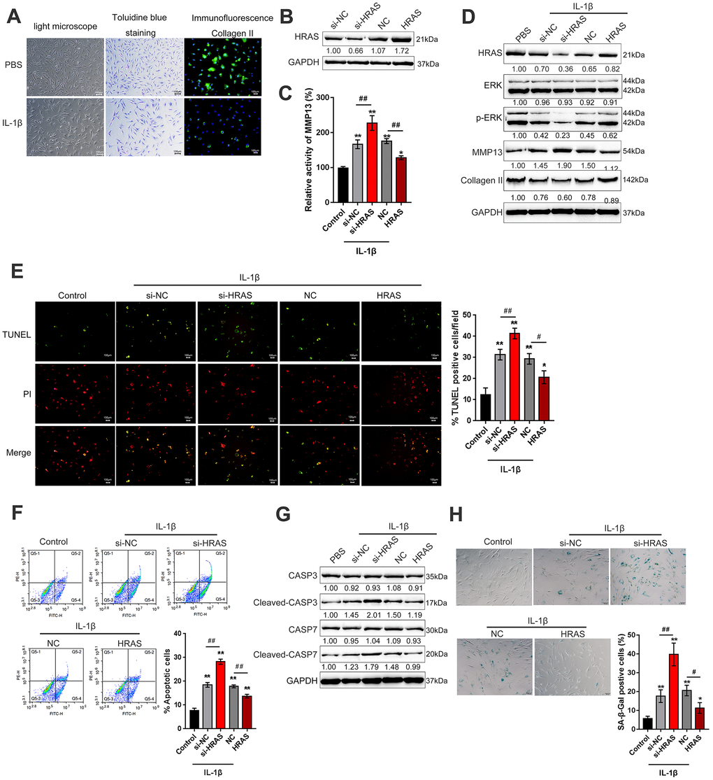 HRAS inhibited IL-1β-induced chondrocyte apoptosis and senescence. (A) Primary OA chondrocytes were isolated, treated with PBS or IL-1β and examined by light microscopy, toluidine blue staining and Collagen II immunofluorescence staining (IF). (B) HRAS knockdown or overexpression was achieved by transfection of si-HRAS or HRAS overexpressing vector into chondrocytes, respectively, and was confirmed using immunoblotting. Transfected chondrocytes were exposed to PBS or IL-1β and then examined for the MMP13 activity by a SensoLytes Plus 520 MMP13 assay kit (C), the protein levels of HRAS, ERK, p-ERK, MMP13 and Collagen II using immunoblotting (D), cell apoptosis using TUNEL assays (E) and Flow cytometer assays (F), the protein levels of Caspase 3, cleaved-Caspase 3, Caspase 7 and cleaved-Caspase 7 using immunoblotting (G), and the SA-β-Gal positive cells were determined by the SA-β-Gal staining (H). The data are presented as mean ± SD of three independent experiments. *PPPP