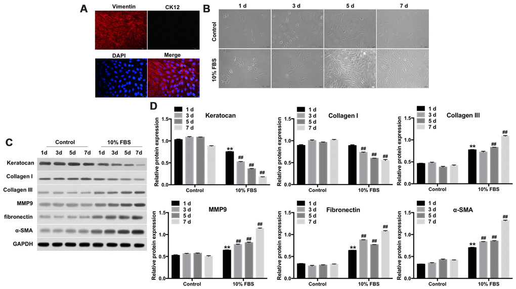 FBS induces differentiation of rabbit corneal keratocytes into myofibroblasts. (A) Representative immunofluorescence images show staining of rabbit corneal stromal cells with fluorescent-tagged antibodies against Vimentin (red) and CK12 (green). Vimentin-positive cells are the keratocytes; CK12-positive cells are the corneal epithelial cells; Diamidinophenylindole (DAPI; blue) stains the nucleus; magnification: 200x. (B) Representative phase-contrast images show phenotypic features of rabbit corneal keratocytes cultured in 10% FBS or serum-free DMEM/F12 medium for 1, 3, 5 and 7 days. The cell cultures were observed under a light microscope and images were captured at 10X magnification. (C) Representative western blot images show levels of keratocan, collagen I, collagen III, MMP9, fibronectin and α-SMA proteins in rabbit keratocyte cells grown in DMEM/F12 medium containing 10% FBS or serum-free medium for 7 days. GAPDH was used as an internal control. (D) Histogram plot shows keratocan, collagen I, collagen III, MMP9, fibronectin and α-SMA protein levels relative to GAPDH. ** denotes P ## denotes P 