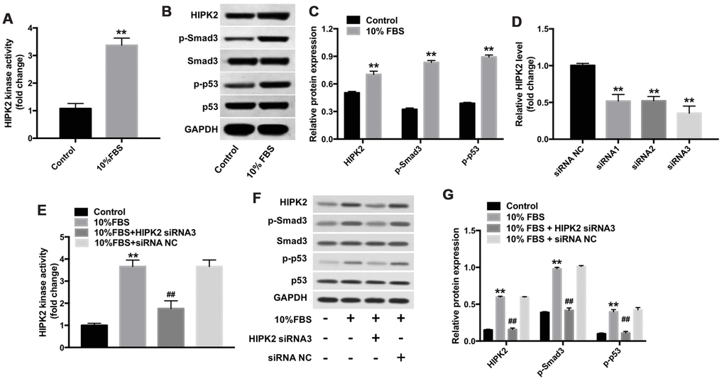 Downregulation of HIPK2 suppresses FBS-induced differentiation of rabbit corneal keratocytes into myofibroblasts. (A) Histogram plot shows HIPK2 kinase activity in rabbit corneal keratocytes grown in DMEM/F12 medium with and without 10% FBS. (B, C) Western blot analysis shows levels of HIPK2, Smad3, p-Smad3, p53, and p-p53 in rabbit corneal keratocytes grown in DMEM/F12 medium with and without 10% FBS. GAPDH was used as internal control. Histogram plot shows levels of HIPK2, p-Smad3, and p-p53 relative to GAPDH, Smad3, and p53, respectively. (D) QRT-PCR analysis shows relative HIPK2 mRNA levels in rabbit corneal keratocytes transfected with NC-siRNA, HIPK2-siRNA1, HIPK2-siRNA2, and HIPK2-siRNA3 for 48 h. β-actin mRNA levels were used for normalization. (E) HIPK2 kinase activity in rabbit corneal keratocytes, transfected with NC-siRNA or HIPK2-siRNA3, and grown in DMEM/F12 medium with 10% FBS for 48 h. (F, G) Western blot analysis shows HIPK2, Smad3, p-Smad3, p53, and p-p53 levels in rabbit corneal keratocytes, transfected with NC-siRNA or HIPK2-siRNA3, and grown in DMEM/F12 medium with 10% FBS for 48 h. GAPDH was used as internal control. Histogram plot shows levels of HIPK2, p-Smad3, and p-p53 relative to GAPDH, Smad3, and p53, respectively. ** denotes P ## denotes P 