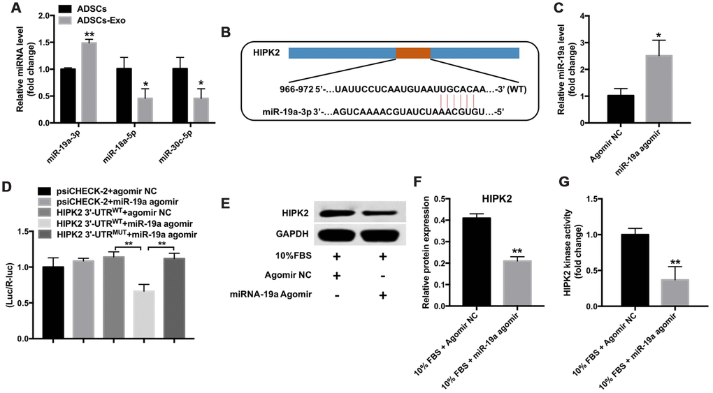 Mir-19a directly binds to the HIPK2-3’UTR. (A) QRT-PCR analysis shows miR-19a, miR-18a-5p and miR-30c-5p levels in ADSCs and ADSCs-Exo. ** denotes P B) Targetscan analysis shows the sequence, 5’-UGCACA-3’, as the predicted target site of miR-19a in the 3’UTR region of the HIPK2 gene between 966-972 nucleotides. (C) QRT-PCR analysis shows levels of miR-19a in the rabbit corneal keratocytes transfected with miR-19a-agomir or NC-agomir for 48 h. ** denotes P D) The dual luciferase reporter assay shows relative luciferase activity in the 293T cells co-tranfected with the plasmids containing HIPK2-WT-3’UTR or HIPK2-MUT-3’UTR and miR-19a agomir. (E, F) Western blotting analysis shows HIPK2 protein expression in rabbit keratocytes, grown in DMEM/F12 medium with 10% FBS, and transfected with miR-19a-agomir or NC-agomir for 48 h. Histogram plot shows HIPK2 protein levels relative to GAPDH. ** denotes P G) Histogram plot shows HIPK2 kinase activity in rabbit keratocytes grown in DMEM/F12 medium with 10% FBS and transfected with miR-19a agomir or NC-agomir for 48 h. ** denotes P 