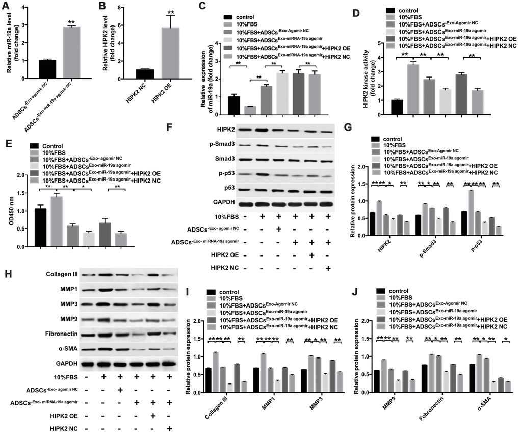 ADSCs-Exo-miR-19a suppresses FBS-induced differentiation of rabbit corneal keratocytes into myofibroblasts by inhibiting HIPK2 expression. (A) QRT-PCR analysis shows miR-19a levels in ADSC-Exo obtained from ADSCs that were transfected with miR-19a-agomir (ADSCs-Exo-miR-19a-agomir) or NC-agomir (ADSCs-Exo-NC-agomir) for 48 h. ** denotes P B) QRT-PCR analysis shows HIPK2 mRNA levels in rabbit corneal keratocytes, transfected with lenti-NC or lenti-HIPK2 for 48 h. β-actin was used as internal control. ** denotes P C) QRT-PCR analysis shows miR-19a levels in lenti-HIPK2 transfected rabbit corneal keratocytes, grown in DMEM/F12 medium with 10% FBS, and incubated with 100 μg/mL ADSCs-Exo-miR19a-agomir or 100 μg/mL ADSCs-Exo-miR19a-agomir. Exosomes were obtained by ultracentrifugation of the cell culture supernatant of ADSCs that were transfected with miR-19a-agomir or NC-agomir for 48 h. ** denotes P D) Histogram plot shows HIPK2 kinase activity in lenti-HIPK2 transfected rabbit corneal keratocytes, grown in DMEM/F12 medium with 10% FBS, and incubated with 100 μg/mL ADSCs-Exo-miR19a-agomir or 100 μg/mL ADSCs-Exo-NC-agomir. ** denotes P E) CCK-8 assay results show viability of lenti-HIPK2 transfected rabbit corneal keratocytes, grown in DMEM/F12 medium with 10% FBS, and incubated with 100 μg/mL ADSCs-Exo-miR19a-agomir or 100 μg/mL ADSCs-Exo-NC-agomir at 0, 2, 48, and 72 h. (F, G) Western blot analysis shows HIPK2, Smad3, p-Smad3, p53, and p-p53 in lenti-HIPK2 transfected rabbit corneal keratocytes, grown in DMEM/F12 medium with 10% FBS, and incubated with 100 μg/mL ADSCs-Exo-miR19a-agomir or 100 μg/mL ADSCs-Exo-NC-agomir. The levels of HIPK2, p-Smad3, and p-p53 proteins are expressed relative to GAPDH, Smad3, and p53, respectively. (H) Western blot analysis of the levels of collagen III, MMP1, MMP3, MMP9, fibronectin and α-SMA proteins in lenti-HIPK2 transfected rabbit corneal keratocytes, grown in DMEM/F12 medium with 10% FBS, and incubated with 100 μg/mL ADSCs-Exo-miR19a-agomir or 100 μg/mL ADSCs-Exo-NC-agomir. GAPDH was used as an internal control. (I, J) Histogram plots show the levels of (I) collagen III, MMP1, and MMP3 and (J) MMP9, fibronectin and α-SMA relative to GAPDH in lenti-HIPK2 transfected rabbit corneal keratocytes, grown in DMEM/F12 medium with 10% FBS, and incubated with 100 μg/mL ADSCs-Exo-miR19a-agomir or 100 μg/mL ADSCs-Exo-NC-agomir. ** denotes P 