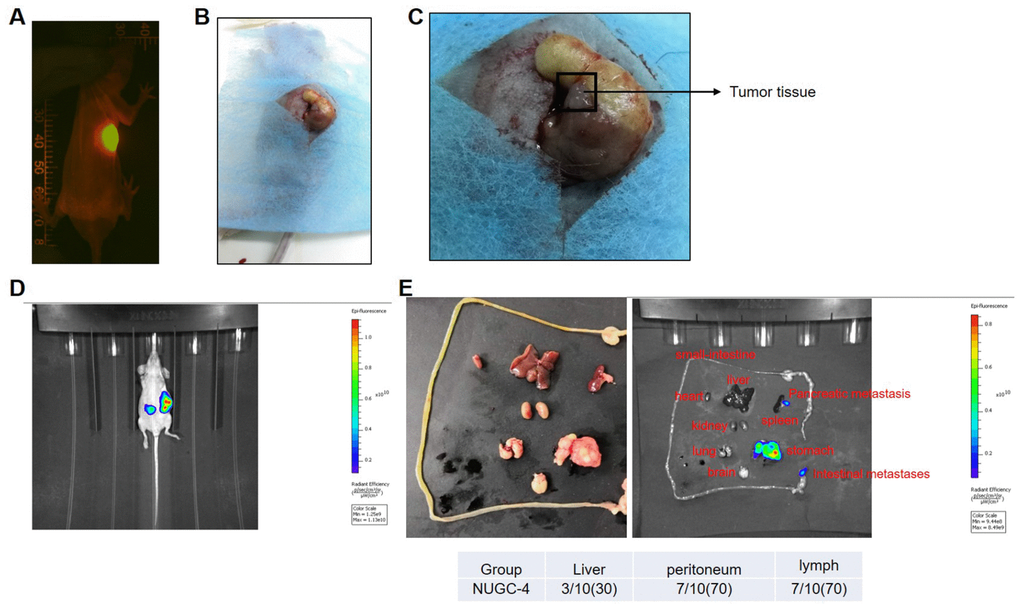 A mouse model of gastric carcinoma was successfully established. (A) A nude mouse model of human gastric carcinoma was constructed through orthotopic transplantation. The gastric orthotopic model was observed with an In Vivo Image System. (B, C) The gastric orthotopically transplanted mice were sacrificed at the end of study, and their gastric tissues are pictured. (D) Tumor metastasis in the mice was detected with an In Vivo Image System eight weeks after gastric orthotopic transplantation. (E) The heart, liver, spleen, lung, kidney, small intestine, peritoneum, lymph and brain tissues of the mice were isolated and photographed eight weeks after gastric orthotopic transplantation.