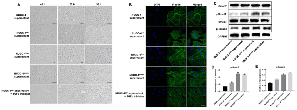 Metastatic gastric cancer cell supernatants significantly altered the morphology of peritoneal mesothelial cells. HMrSV5 cells were co-cultured with NUGC-4, NUGC-4per, NUGC-4liver, NUGC-4lym cell supernatants and NUGC-4per cell supernatants + TGF-β inhibitor for 48, 72 and 96 h. (A) The morphology of HMrSV5 cells was observed under an optical microscope at 48, 72 and 96 h. (B) DAPI and F-actin were detected by an immunofluorescence assay in HMrSV5 cells co-cultured with NUGC-4, NUGC-4per, NUGC-4liver, NUGC-4lym cell supernatants and NUGC-4per cell supernatants + TGF-β inhibitor for 72 h. (C–E) The relative levels of p-Smad2 and p-Smad3 in peritoneal mesothelial cells were detected by western blotting. **P