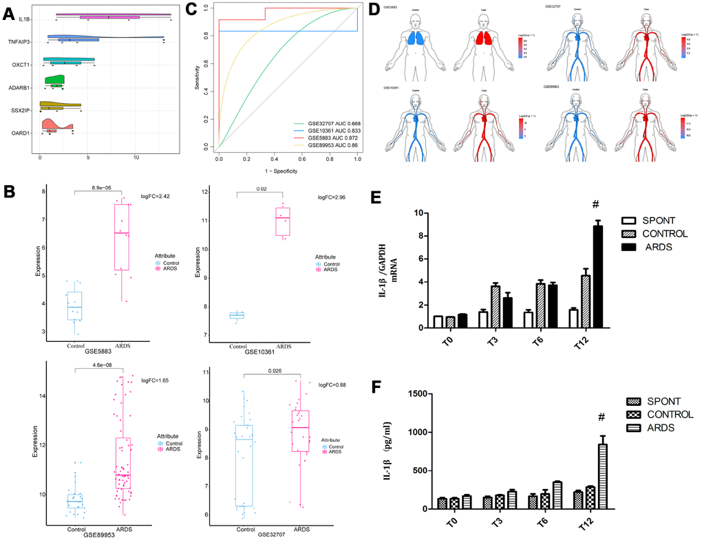 Expression of core gene IL-1β. (A) The differentially expressed genes were scored according to the degree of similarity between genes and genes. (B) IL-1β appeared in the four data sets of ARDS Significantly high expression. (C) ROC curve analysis indicated IL-1β can distinguish ARDS and control in the four data sets. (D) IL-1β was up-regulated in lung and whole blood. (E) The concentration of IL-1β in lung tissue in patients with ARDS was significantly elevated. (F) The concentration of IL-1β in lung tissue and bronchoalveolar lavage fluid in patients with ARDS was significantly elevated. #, P 