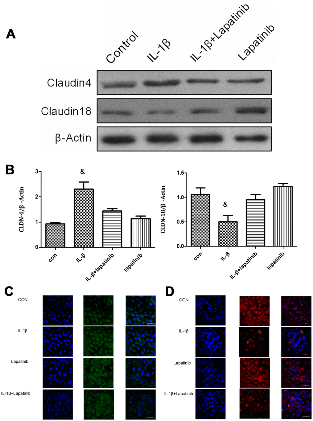 Analysis of claudin4/18 expression and localization. (A, B) The expression of claudin4 expression was significantly up-regulated while the expression of claudin18 was significantly down-regulated in the IL-1β group. &, P C) Claudin4 immunofluorescence was increased significantly in the cell membrane localization. (D) Claudin18 immunofluorescence results was reduced significantly in cell membrane localization.